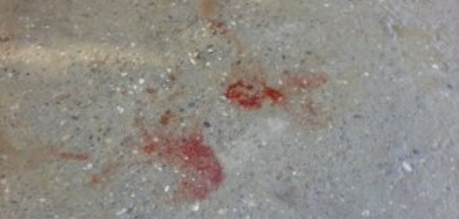 В Калачинске Toyota насмерть сбила 12-летнего мальчика