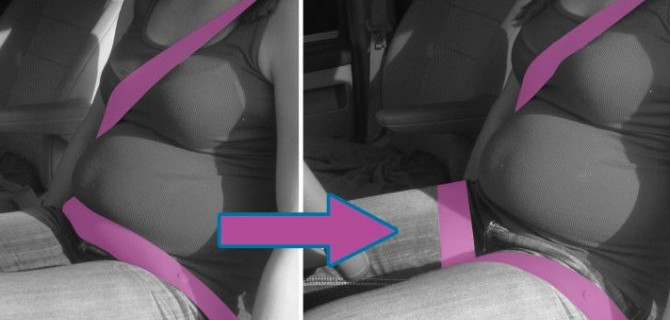 В США изобрели ремни безопасности для беременных женщин