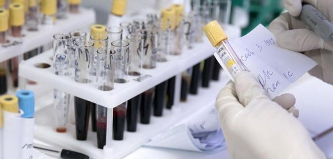 Чем закончилась история с приказом Минздрава, из-за которого стало так сложно и дорого получить медицинскую справку для водительских прав